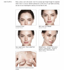 EPLINE PDO THREAD – Barbed Thread – Molding Cog (SC Type) 4 EPLINE PDO THREAD – Barbed Thread – Molding Cog (SC Type) -Farmacia Estetica Porta Pia Barbed Thread 1